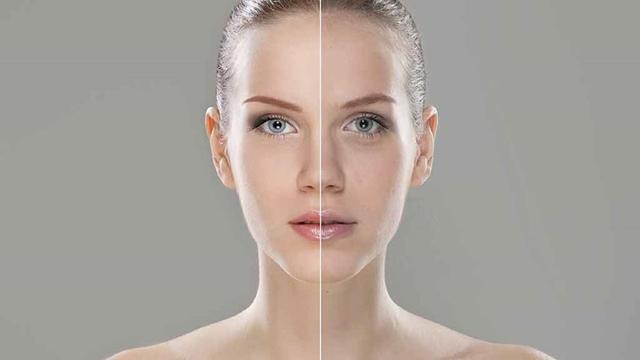 woman pre and post treatment.jpg