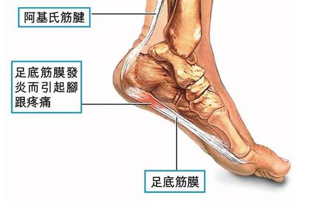 跑者最常见的9种伤病 你一定碰到过